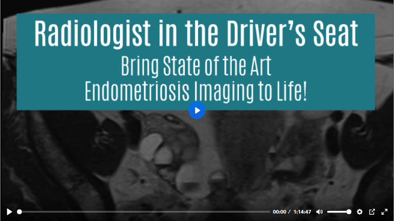 Endometriosis DFP webinar